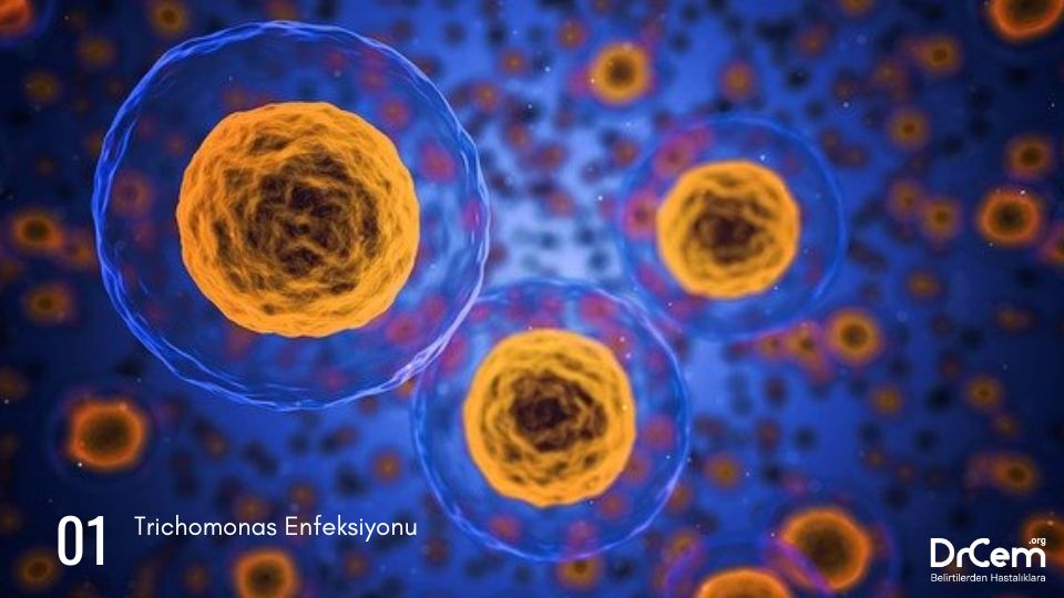 Trichomonas Enfeksiyonu görseli - DrCem hastalık rehberi